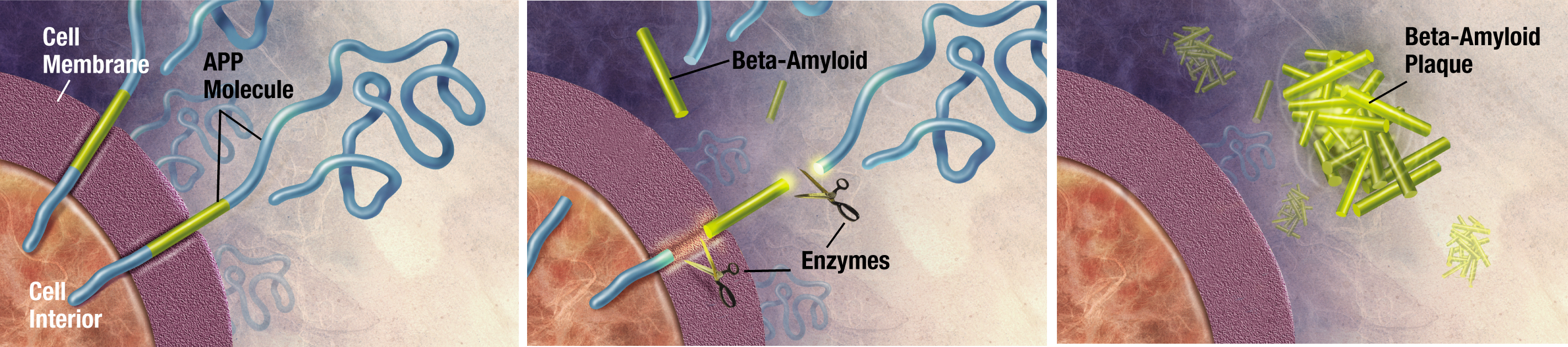 Amyloid Plaque Formation Mechanism